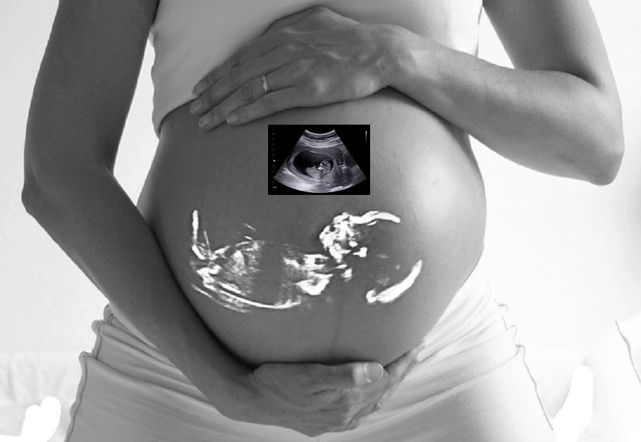 ultrasonido, transfontanelar, fontanela, mollera, imagen, cabeza,